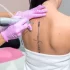 Removing Tattoos Safely: Why Choose a Professional Laser Treatment